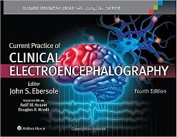 Current Practice of Clinical Electroencephalography,2015 CQ3BtC