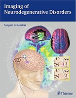 imaging - Imaging of Neurodegenerative Disorders DfcqF4