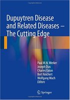 diseases - Dupuytren Disease and Related Diseases Drg5Gu