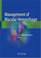 Management of Macular Hemorrhage 1st ed. 2018 Edition O9YGVN