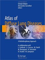 atlas - Atlas of Diffuse Lung Diseases: A Multidisciplinary Approach,2017 IACNZt