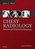 Radiology - Chest radiology : patterns and differential diagnoses 7e Qr9jOM