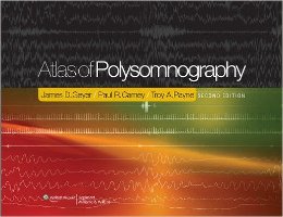 Atlas - Atlas of Polysomnography Second Edition TWVYTC