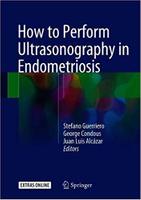 How to Perform Ultrasonography in Endometriosis Ud6JoM