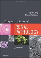 Atlas - Diagnostic Atlas of Renal Pathology, 3e V02OIW