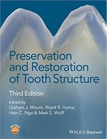 Preservation and Restoration of Tooth Structure 3rd Edition 41xsoK