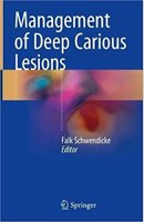 Management of Deep Carious Lesions Dk2nJU