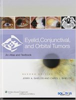 Eyelid, Conjunctival, and Orbital Tumors Ptj5uz