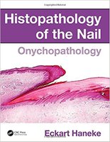 Histopathology of the Nail XMfnVC