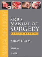 Manual - Srb's Manual of Surgery 4th Edition IFdg9i