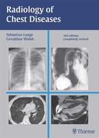 Radiology of Chest Diseases Hardcover – 2007 IKYCvk