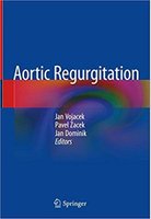 Aortic Regurgitation 1st ed. 2018 Edition LVjOQG