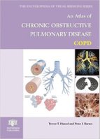 An Atlas of Chronic Obstructive Pulmonary Disease (Encyclopedia of Visual Medicine Series) NNItMJ