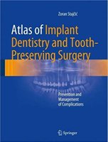 Atlas of Implant Dentistry and Tooth-Preserving Surgery RkMw1C