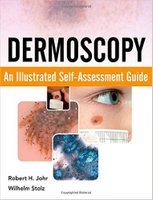 Guide - Dermoscopy: An Illustrated Self-Assessment Guide 1st Edition 2fRPS9