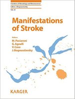 Manifestations of Stroke AG3spS