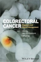 Colorectal Cancer: Diagnosis and Clinical Management LwWGnk