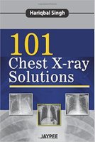 101 Chest X-ray Solutions QUotHJ