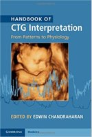 Handbook of CTG Interpretation RIfJTD