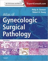 pathology - Atlas of Gynecologic Surgical Pathology: Expert Consult:2014 Wj9sHf