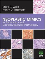 Neoplastic Mimics in Thoracic and Cardiovascular Pathology B8jhkm