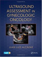 Oncology - Ultrasound Assessment in Gynecologic Oncology BQa5K8