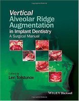 Vertical Alveolar Ridge Augmentation in Implant Dentistry HBXTp1