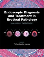 Endoscopic Diagnosis and Treatment in Urethral Pathology ZM86Mv