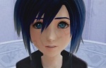 xion*