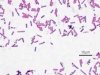 Bacillus subtilis, known as the hay bacillus or grass bacillus, is a Gram-positive, catalase-positive bacterium commonly found in soil. A member of the genus Bacillus, B. subtilis is rod-shaped, and has the ability to form a tough, protective endospore, allowing the organism to tolerate extreme environmental conditions. Unlike several other well-known species, B. subtilis has historically been classified as an obligate aerobe, though recent research has demonstrated that this is not strictly correct.