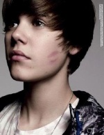 Kiss Justin Bieber